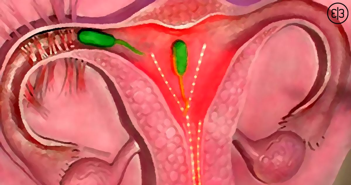 Изображение статьи 3